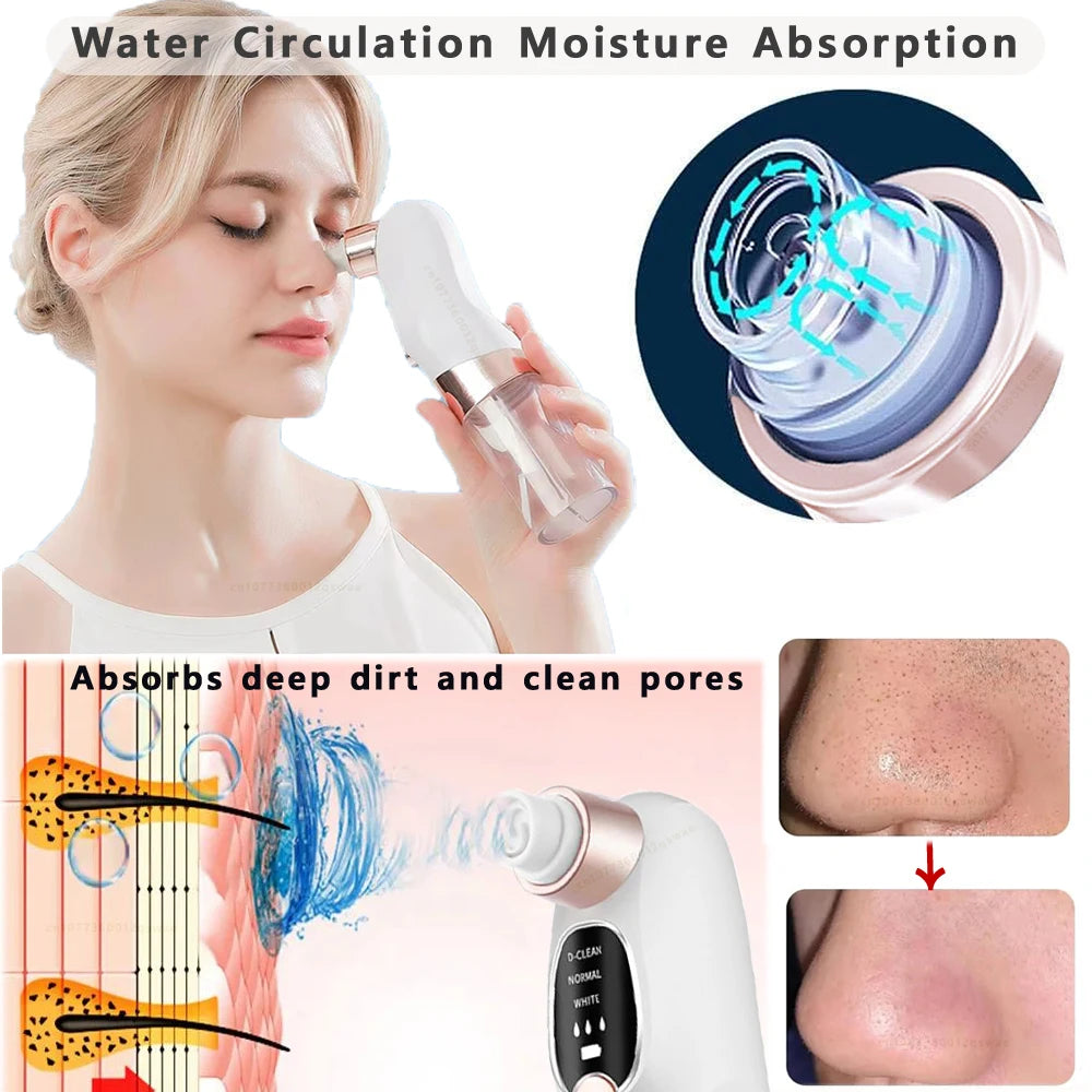 🌟 Succionador de Puntos Negros – Mini Pore Vacuum