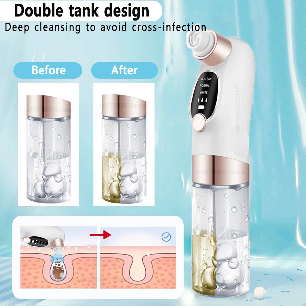 🌟 Succionador de Puntos Negros – Mini Pore Vacuum